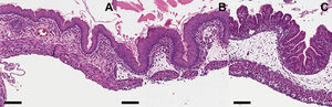 Represents the inflammatory findings of the gastroschisis villus indifferent gestational ages. Cross sections of intestinal villi obtained from GS 18 (A), GS 19 (B) and Controls (C). Note the increased number of inflammatory cells in the mucosa of the bowel of the fetuses with gastroschisis groups. Scale bar = 100 micrometer.