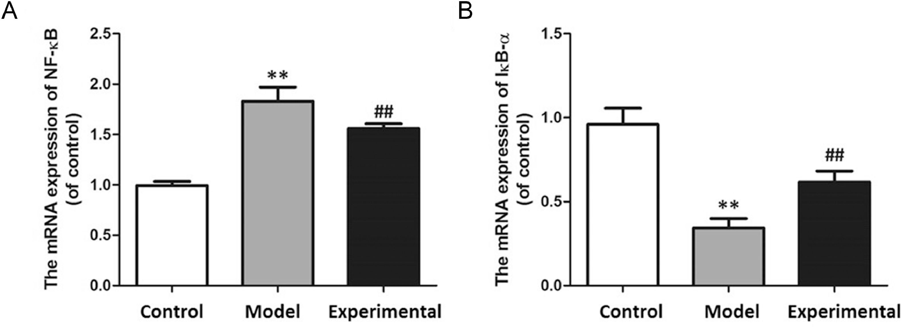 Effects of aerobic exercise on myocardial injury, NF-B expression ...