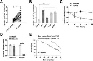 circCPA4 high expression in PC. (A‒B) Higher circCPA4 expression in PC tissues versus normal tissues and in PC cell lines versus RWPE. (C‒D) circCPA4 had ring structure and high stability. (E) Negative relationship between circCPA4 and survival prognosis of PC patients.