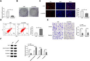 circCPA4 knockdown suppresses PC3 cell activities. (A) si-circCPA4 lowered circCPA4 expression. (B‒C) circCPA4 reduced cell proliferation. (D) circCPA4 enhanced apoptosis rate. (E) circCPA4 reduced invasion and migration abilities. (F) circCPA4 reduced Ki-67 and N-cadherin and elevated cleaved caspase-3 and E-cadherin.