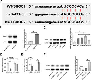 SHOC2 shows the downstream target gene of miR-491-5p. (A) SHOC2 and miR-491-5p shared potential binding sites. (B‒C) Higher SHOC2 expression in PC tissues versus normal tissues and in PC cell lines versus RWPE. (D‒E) SHOC2 and miR-491-5p had a targeting binding relationship. (F) miR-491-5p mediated SHOC2 protein expression.