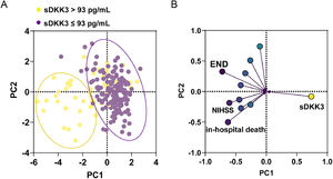 Unsupervised principal component analysis (A) and load analysis (B) of serum DKK3 levels and clinical features.
