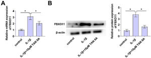 TAN IIA regulates FBXO11 expression. (A‒B) FBXO11 in designated treated CHON-001 cells measured by RT-qPCR and Immunoblot assay. Data are expressed as mean ± SD (n = 3) (* p < 0.05).