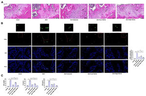TAN IIA treatment improves apoptosis and inflammation of chondrocytes in OA rats. (A) HE-staining of articular cartilage. (B) TUNEL staining determined apoptosis of rat cartilage. (C) TNF-α, IL-6, and iNOS in chondrocytes of OA rats detected by ELISA. Data are expressed as mean ± SD (n = 10). (*p < 0.01).