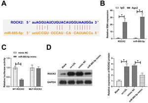 ROCK2 is a target gene of miR-885–5p. Potential binding sites of ROCK2 and miR-885–5p on the https://starbase.sysu.edu.cn (A), verification of ROCK2 and miR-885–5p targeting relationship (B-C); ROCK2 expression in VMSCs after overexpression of miR-885–5p (D); data are expressed as mean ± SD (n = 3); *p < 0.05.