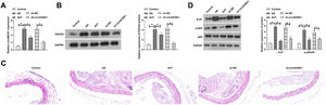 Knockdown of circABCA1 reduces arterial plaque size and improves inflammation in AS mice. circABCA1 and ROCK2 expression in aortic tissue (A‒B); HE staining to detect aortic pathological damage (C); IHC staining to assess the number of positive cells for OPN and α-SMA in the aorta (D); Ki-67 and P-NF-κB protein expression in the aorta (E); data are expressed as mean ± SD (n = 5); *p < 0.05.