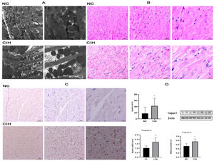 Morphological and ultrastructural changes and increased apoptosis in cardiomyocytes caused by CIH. (A) Comparison of myocardial TEM images of rats in the CIH and NC groups. (B) Comparison of myocardial HE-staining images of rats in the CIH and NC groups. (C) TUNEL staining showed that the apoptotic rate of cardiomyocytes in rats with CIH significantly increased. (D) mRNA and protein expression levels of apoptosis-related protein caspase-3 significantly increased in the CIH group (*p < 0.05).