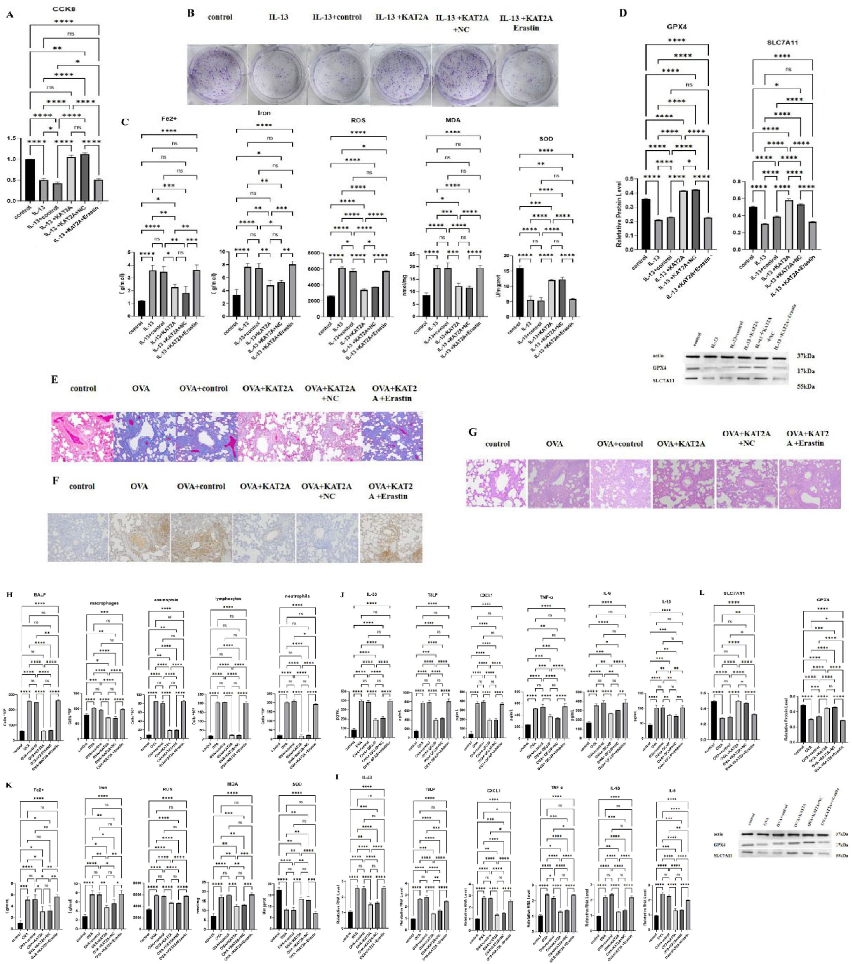 Molecular mechanism of modified KAT2A-mediated histone succinylation in ...