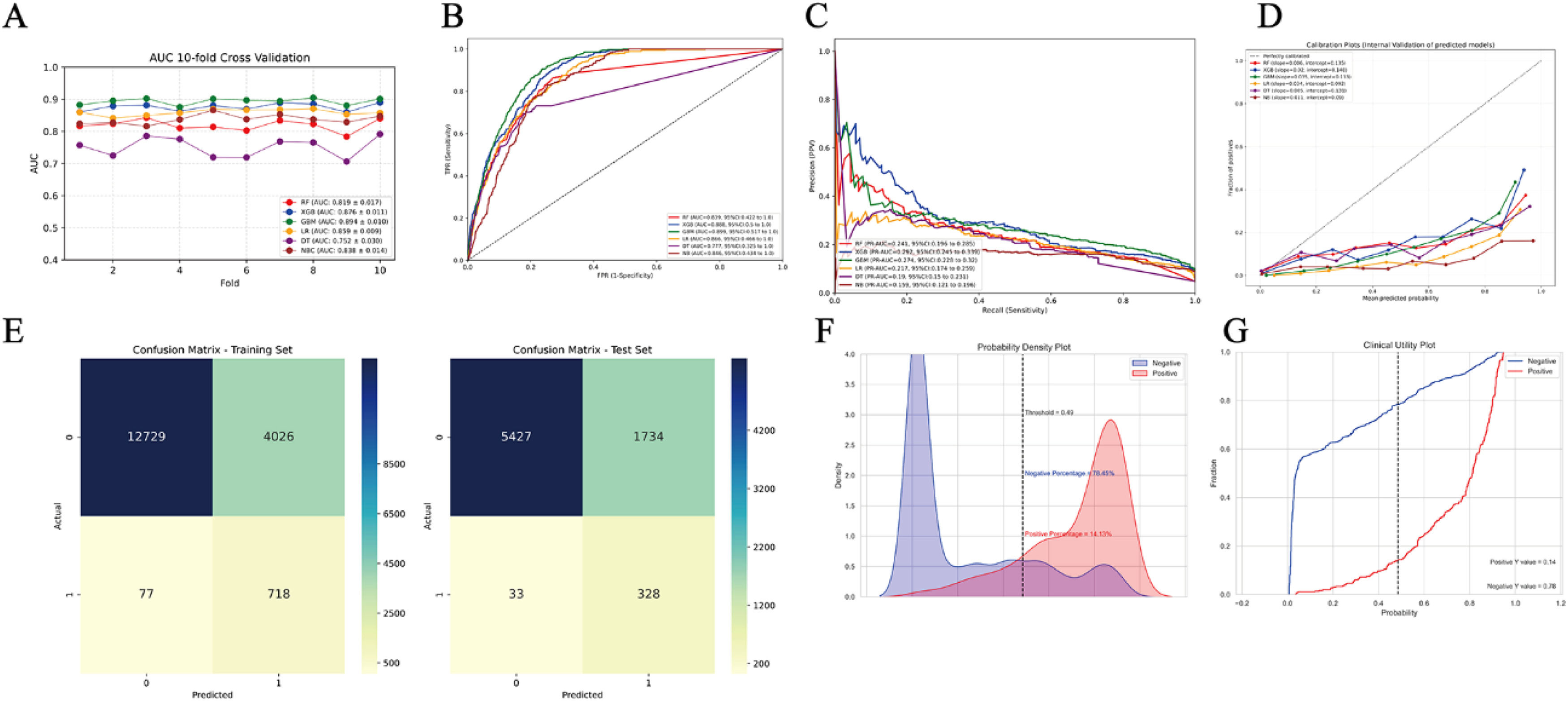 Development and validation of a machine learning model and nomogram for ...