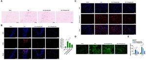 GpS ameliorates Sev-induced neuronal damage in rats. (A) HE staining to assess neuronal damage in rats; (B) TUNEL to assess apoptosis in rat neurons; (C) Immunofluorescence to measure Cleaved caspase-3 expression in rat hippocampal tissues; (D) Measurement of ROS production in hippocampal neurons using fluorescence microscope; (E) ELISA to determine TNF-α and IL-6 in rat hippocampal tissues. Data are expressed as mean ± SD (n = 5). *p < 0.05.