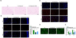 PI3K/AKT/mTOR pathway inhibitor impairs the ameliorative effect of high-dose GpS on neuronal cell damage in Sev-anesthetized rats. (A) HE staining to assess neuronal damage in rats; (B) TUNEL to assess apoptosis in rat neurons; (C) Immunofluorescence to measure Cleaved caspase-3 expression in rat hippocampal tissues; (D) Measurement of ROS production in hippocampal neurons using fluorescence microscope; (E) ELISA to determine TNF-α and IL-6 in rat hippocampal tissues. Data are expressed as mean ± SD (n = 5). *p < 0.05.