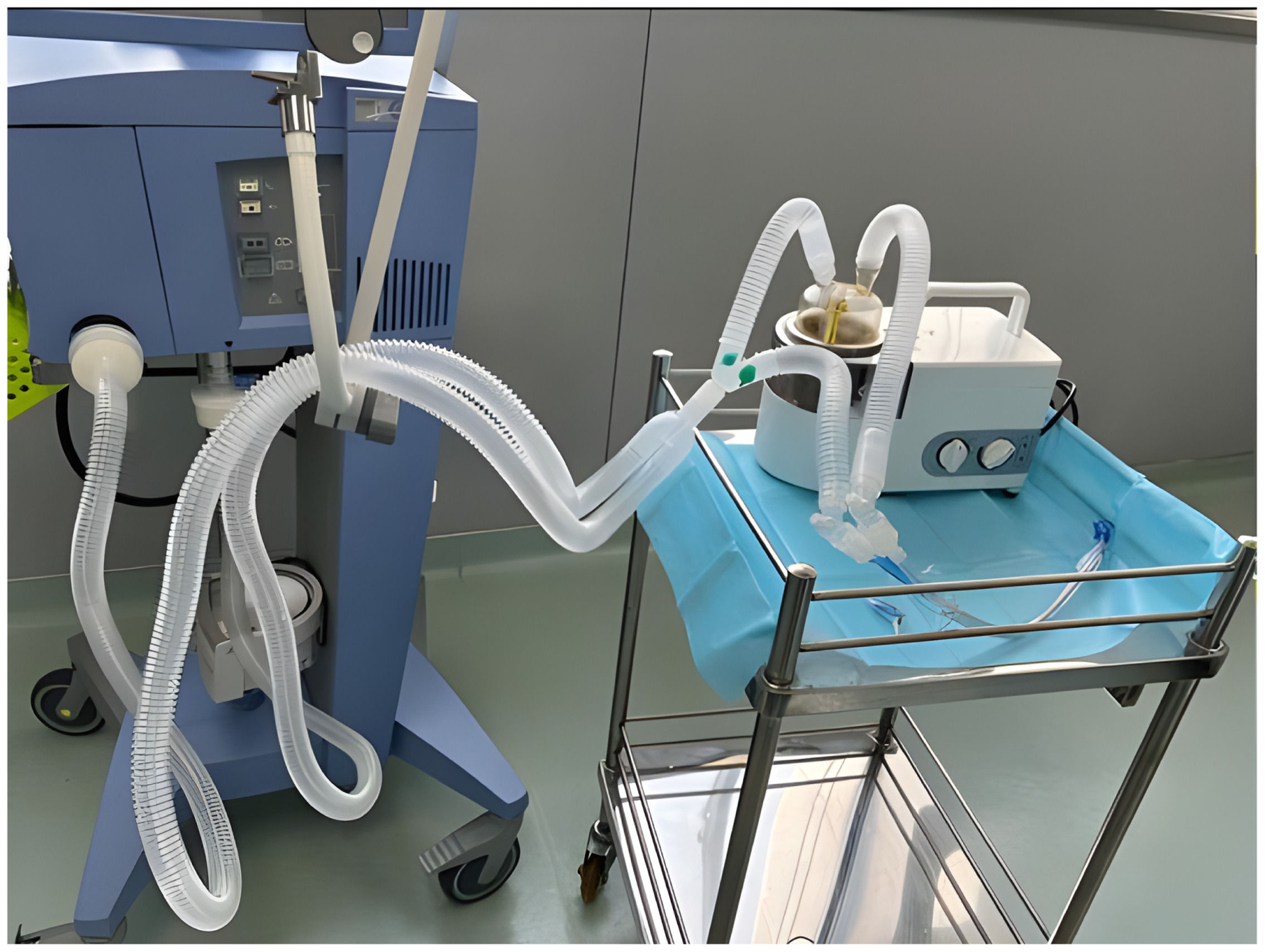 Aerosolized prostaglandin E1 improves oxygenation during one-lung ...