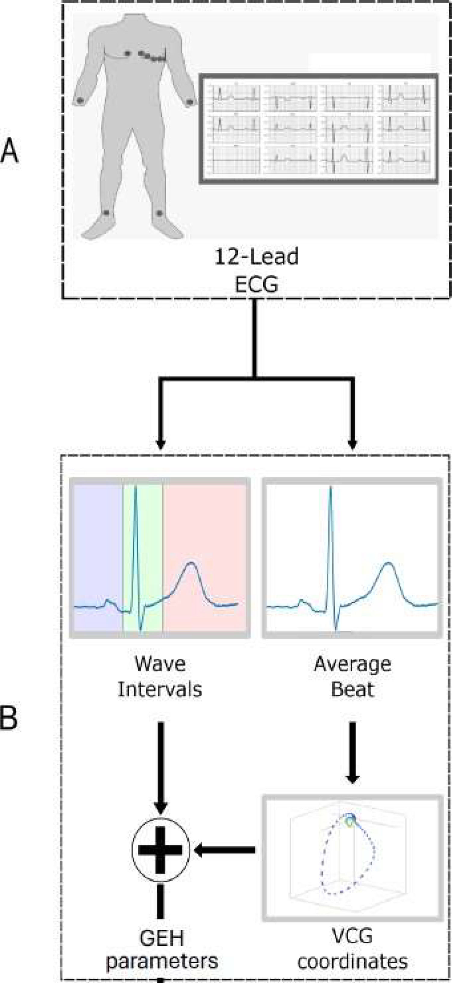 Enhancing tertiary cardiology triage with vectorcardiographic features ...