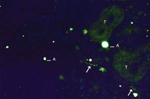 Example of labeling grade 1. Rare fibers identified (arrows). Artifact (A) and tissue auto-fluorescence (T).