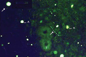 Example of labeling grade 2. Sparse fibers (arrows). Tissue auto-fluorescence (T) and artifacts (A).