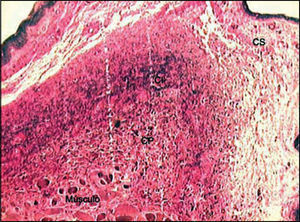 Distribution of elastic fibers in the lamina propria layers stained by Verhoeff. (Fragment - 3, magnification 40 X). CS - superficial layer, CI - intermediate layer, CP - deep layer.