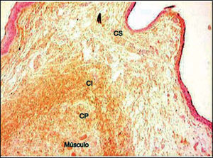 Distribution of tropoelastin on lamina propria layers. (Fragment - 4, magnification 40 X). CS - superficial layer, CI - intermediate layer, CP - deep layer.