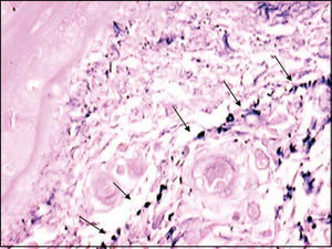 Plexus of elastic fibers (arrows) parallel to basal membrane stained with resorcin-fuchsin of Weighert. (Fragment - 4, magnification 400 X).