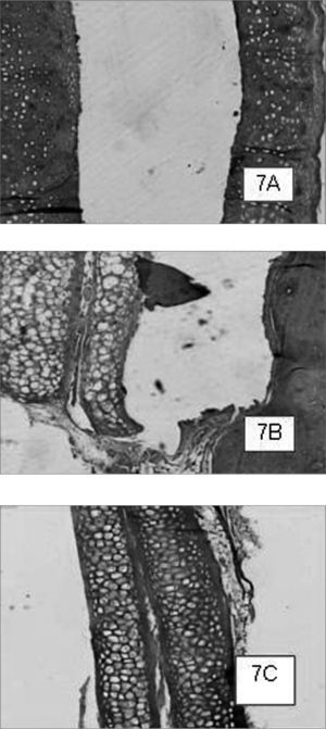 Cyanoacrylate-bound cartilage fragments in animals slaughtered within 2 (7A), 6 (7B) and 12 (7C) weeks after the procedure, respectively. In case 7A, within 2 weeks we see the cartilage fragments detachment, and in case 7B we see the shifting between cartilage sandwich and the cranial bone. HE 50X A.O.
