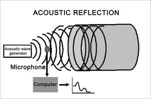 Outline of acoustic pharyngometry