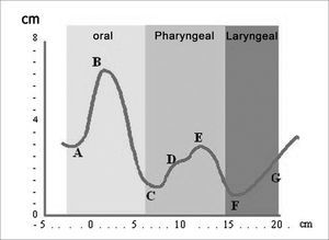 Pharyngogram: morphology