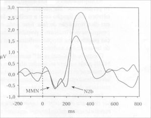 Long latency auditory evoked potential diagram - MMN - Source: SCHOCHAT, 2004, p. 665.