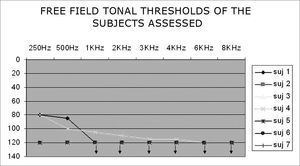 Free-field pure tone thresholds of subjects - Note: Observe response overlap in subjects 2, 3, 5, 6 and 7.