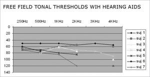 Free-field pure tone thresholds with hearing aids - subjects 1, 2, 3, 4, 5, 6 and 7 - subjects of the 0 – 140 dB sample - Free field pure tone thresholds with hearing aids.