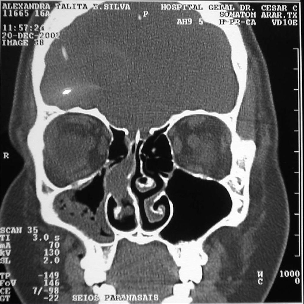 fig1