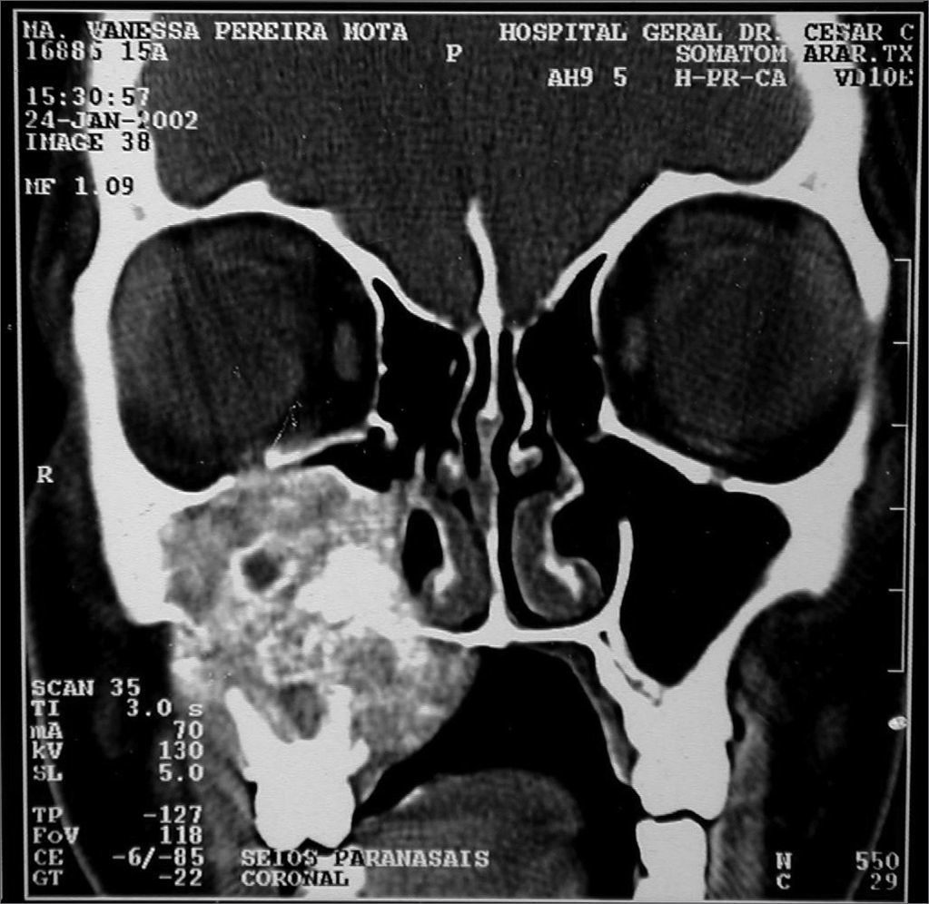 fig10