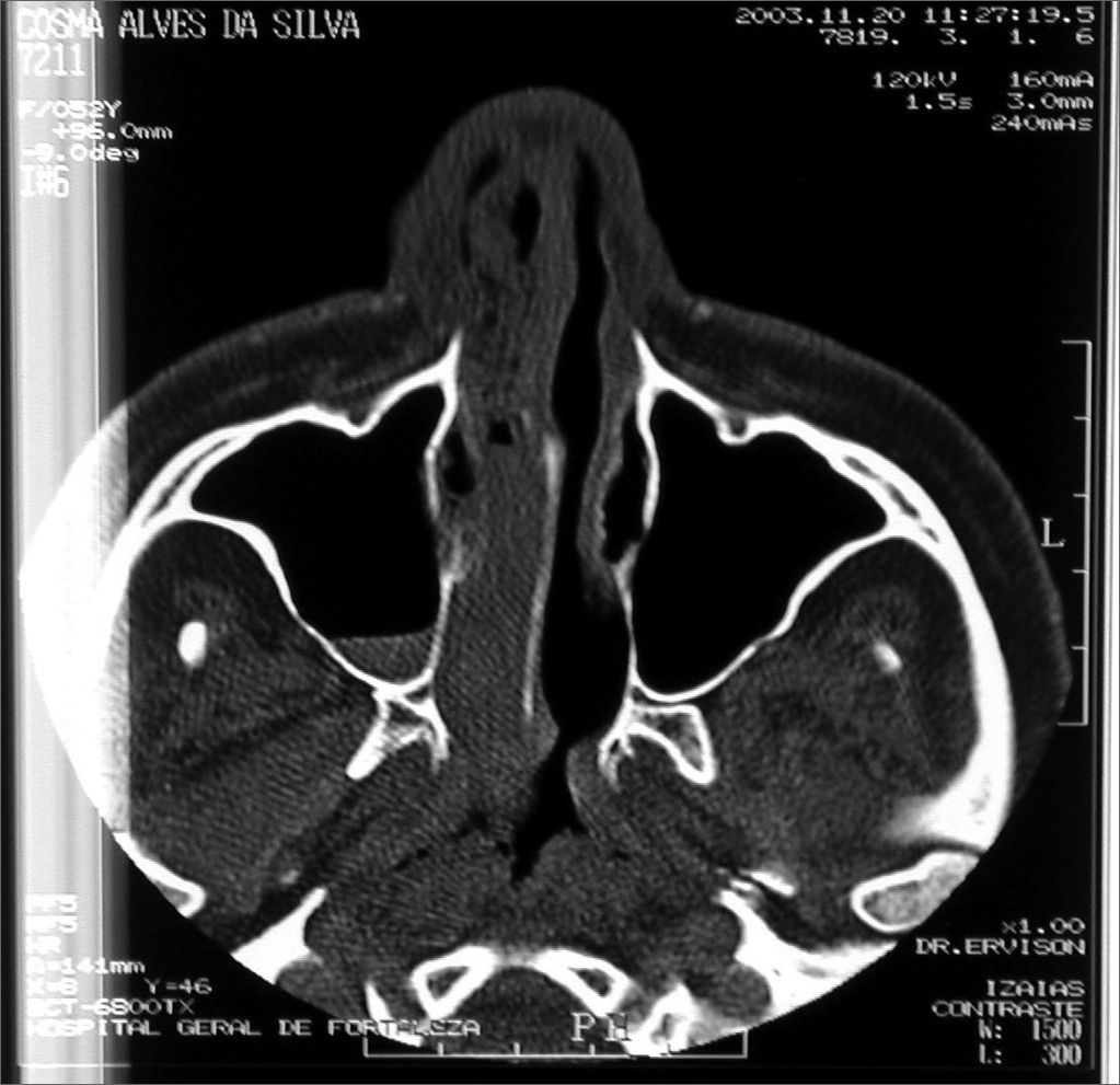 fig6