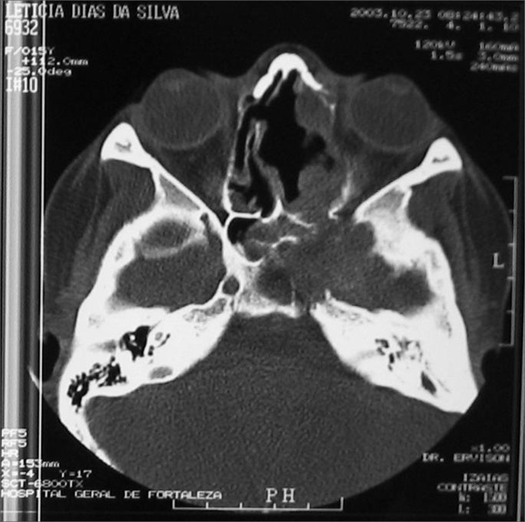 fig8