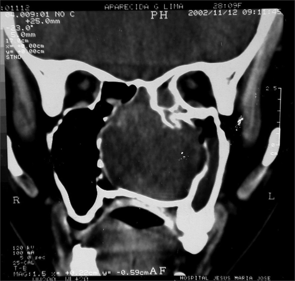 fig9