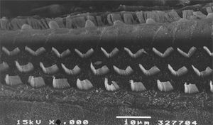 Scanning electron microscopy of a group 2 animal. Note preserved cilia in OHCs in the basal portion of the cochlea. Scale = 10µM; 2000X magnification.