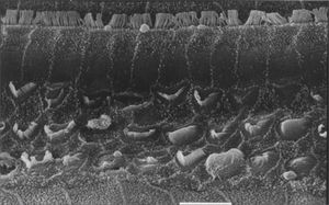 Scanning electron microscopy of a group 3 animal (EA and cisplatin treated). Note extensive OHC injury in the basal portion of the cochlea. Scale = 10µM; 2000X magnification.