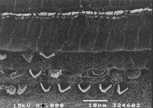 Scanning electron microscopy of a group 4 animal (EA and cisplatin treated - 3g/d). Note less intense OHC injury in the basal portion of the cochlea. Scale = 10µM; 2000X magnification. Maytenus ilicifolia in the prevention of cisplatin-induced ototoxicity.
