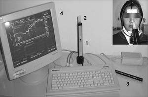 Acoustic rhinometer (Eccovision, Hood Laboratories): instrumentation to check nasal cavity cross-sectional areas; 1=sound tube; 2= nasal adapter; 3=calibration tube 4=computer monitor showing a rhinogram. See patient in position for data acquisition.