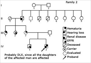 Family 2 Inheritance pattern - Probably DLX, because all daughters of the affected II-2 were affected.