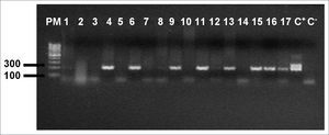 Agarose gel (1,7%) electrophoresis showing amplification of the EBV genome, (209bp) PM - Molecular weight 100bp, Samples 1 - 17, C+ - DNA extracted from the line B9507, C- - Milli-Q water.