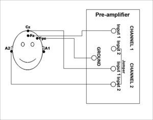 Illustration of the electrodes placement on a patient's skull according to the international 10–20 system and the cable connections on the pre-amplifier cables of the Auditory Evoked Potentials recording system.