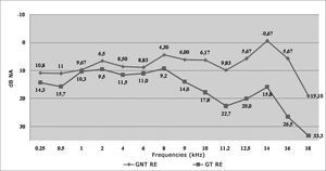 Variation of the Right Ear (RE) auditory threshold mean values among non-smokers (NS) and smokers (SG).