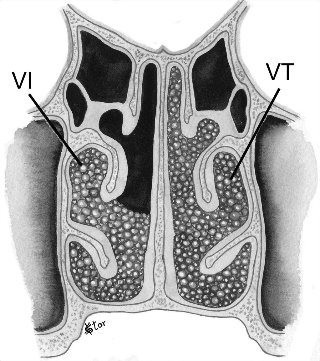 Reproducibility of the three-dimensional endoscopic staging system for ...