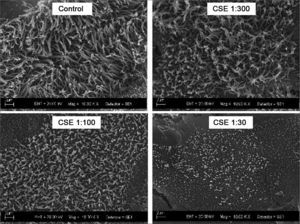 Scanning electron microscopy photographs showing the dose-dependent effect of cigarette smoke on cilia size after exposure to decreasing dilutions of the Cigarette Smoke Extract (CSE).