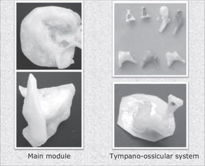 Main module and tympano-ossicular system.