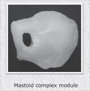 Mastoid complex module.