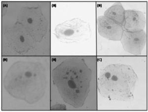 Test of micronuclei in study subjects: (A) Cell without micronuclei; (B) Cells with one or more micronuclei; (C) Binucleated cell. - (the image has no key).