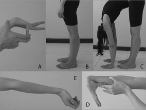 Temporomandibular disorder and generalized joint hypermobility ...