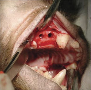 Perforations communicating with the maxillary sinus.