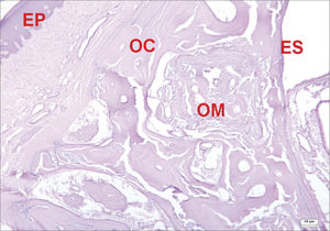 Histological section of an experimental surgical defect with no bone discontinuity, showing bone regeneration sites (hematoxylin-eosin stained). Compact bone (OC); medullary bone (OM); squamous epithelium (EP); sinus epithelium (ES).