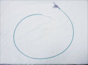 Angioplasty catheter used in the balloon laryngoplasty.